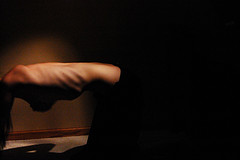 Fainting: one of the health risks of anorexia Fainting: one of the health risks of anorexia